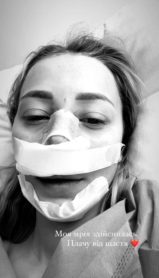Змінила зовнішність: дружина Віктора Павліка зробила операції на носі та підборідді – Modista - Жіночий журнал Змінила імідж: дружина Віктора Павліка зробила операції на носі та підборідді