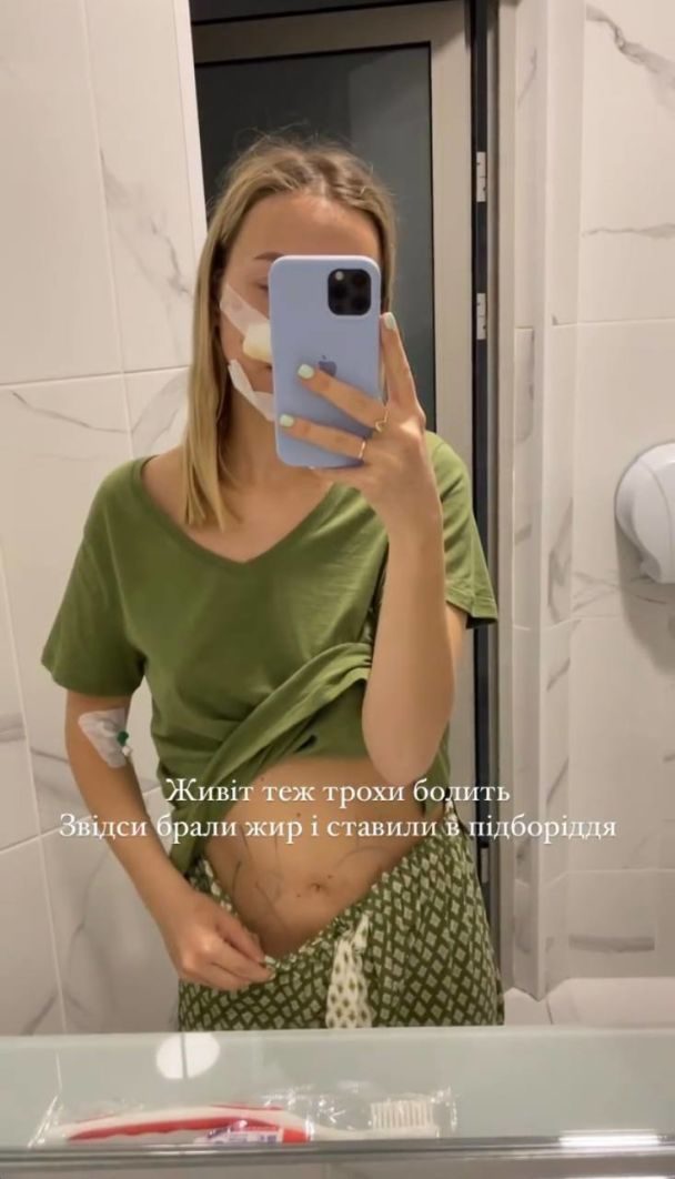 Змінила зовнішність: дружина Віктора Павліка зробила операції на носі та підборідді – Modista - Жіночий журнал Змінила імідж: дружина Віктора Павліка зробила операції на носі та підборідді