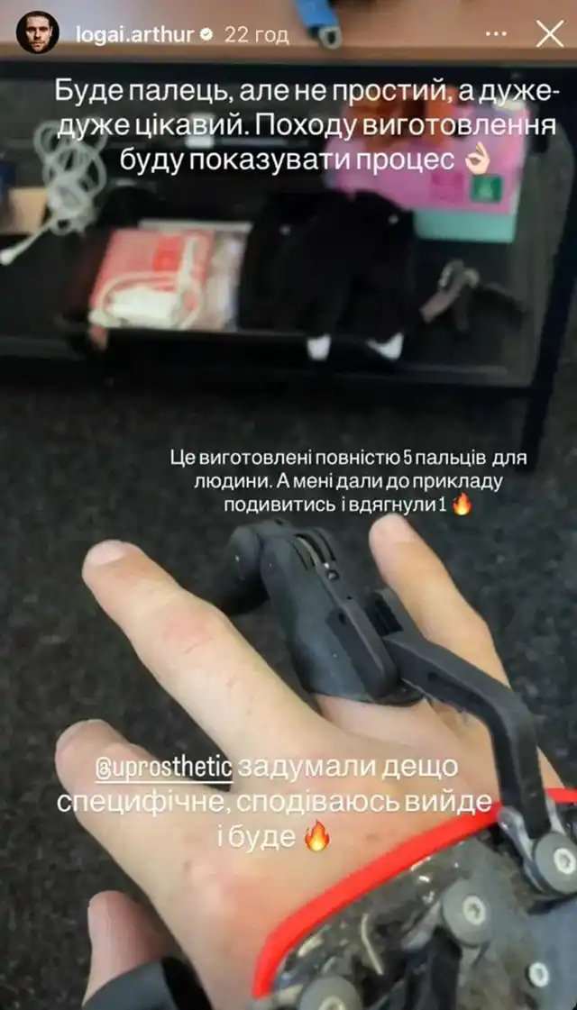 Зірки. Артур Логай, який відірвав палець, показав як примірює протез &ndash; Modista - Жіночий журнал