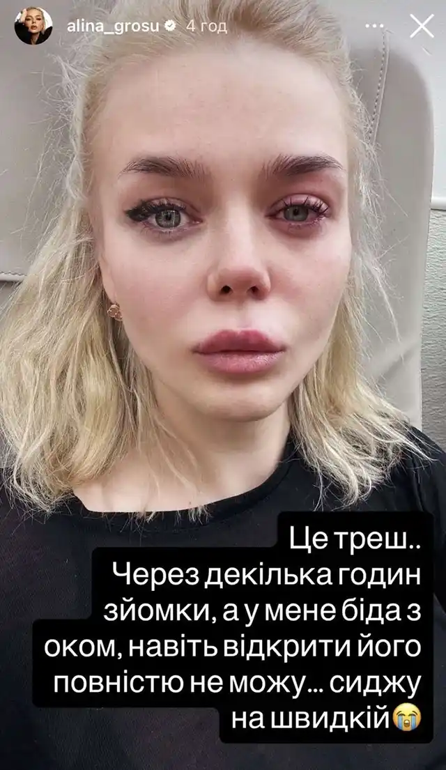 Шокуюче Зізнання Співачки Аліни Гросу: Чому Вона Опинилася У Швидкій І Закликала «Не Нарощувати Вії» – Modista - Жіночий журнал Зірки. Шокуюче Зізнання Співачки Аліни Гросу: Чому Вона Опинилася У Швидкій І Закликала «Не Нарощувати Вії» – Modista - Жіночий журнал